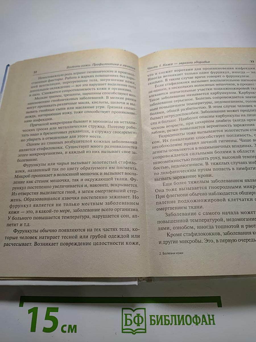 Болезни кожи. Профилактика и лечение