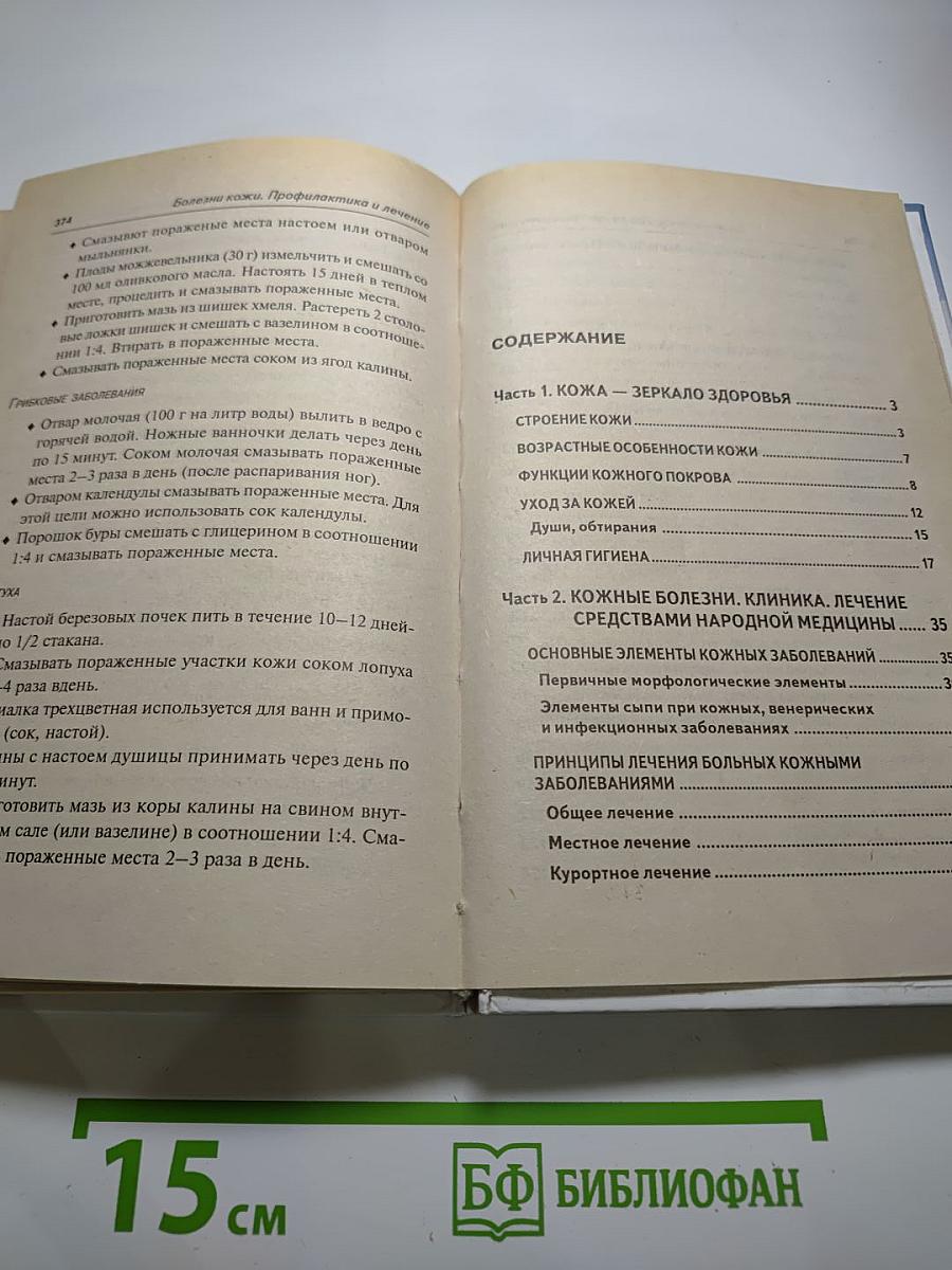 Болезни кожи. Профилактика и лечение