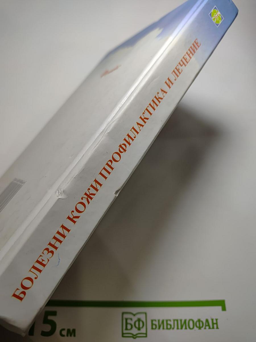 Болезни кожи. Профилактика и лечение