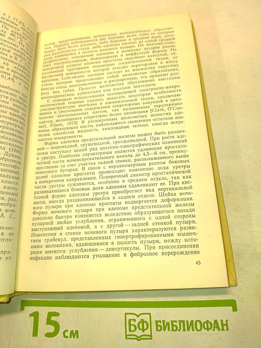 Хирургическое лечение аденомы и рака предстательной железы
