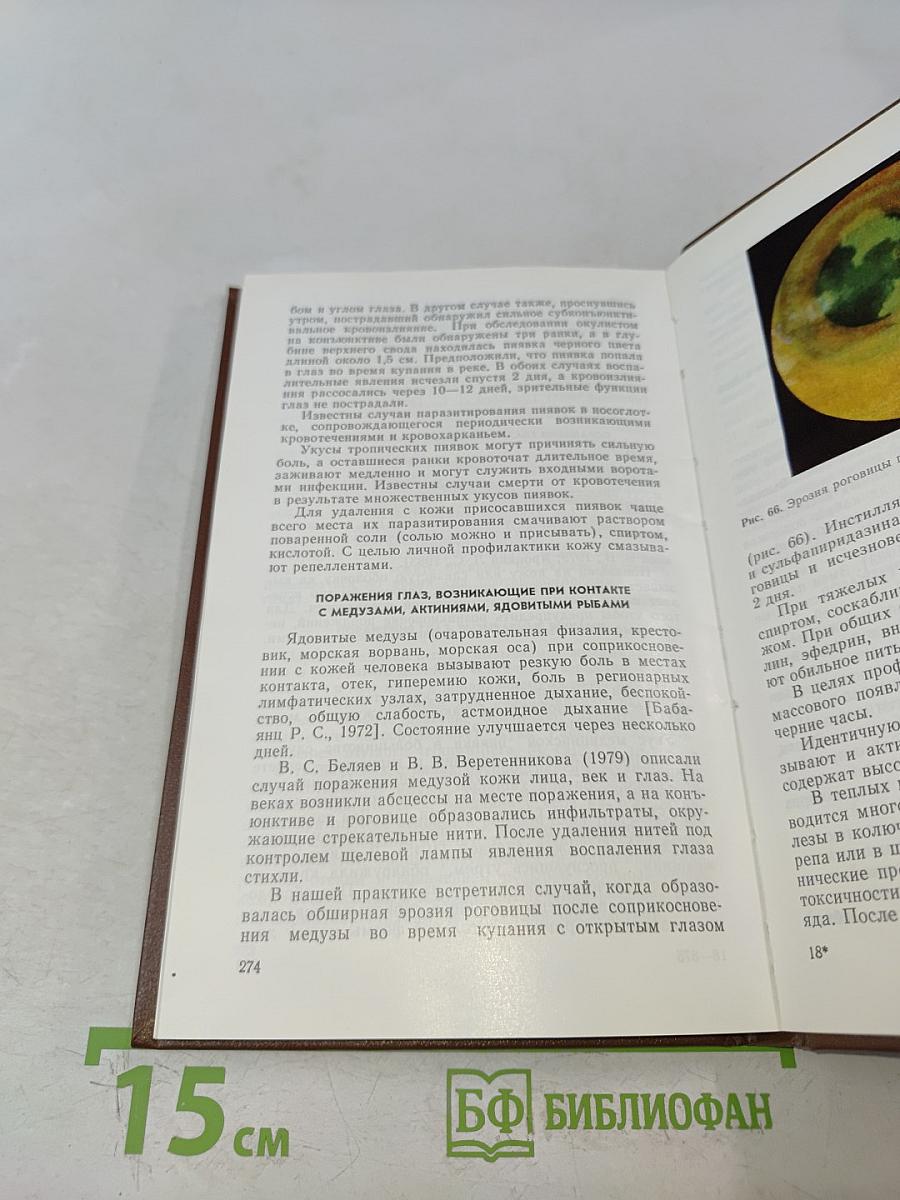 Паразитарные заболевания глаз