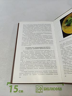 Паразитарные заболевания глаз