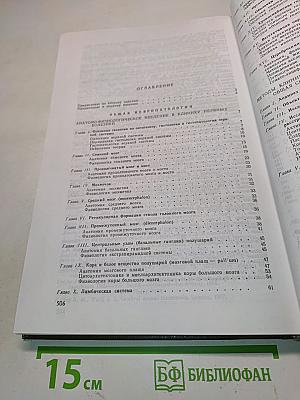 Нервные болезни. Руководство для врачей