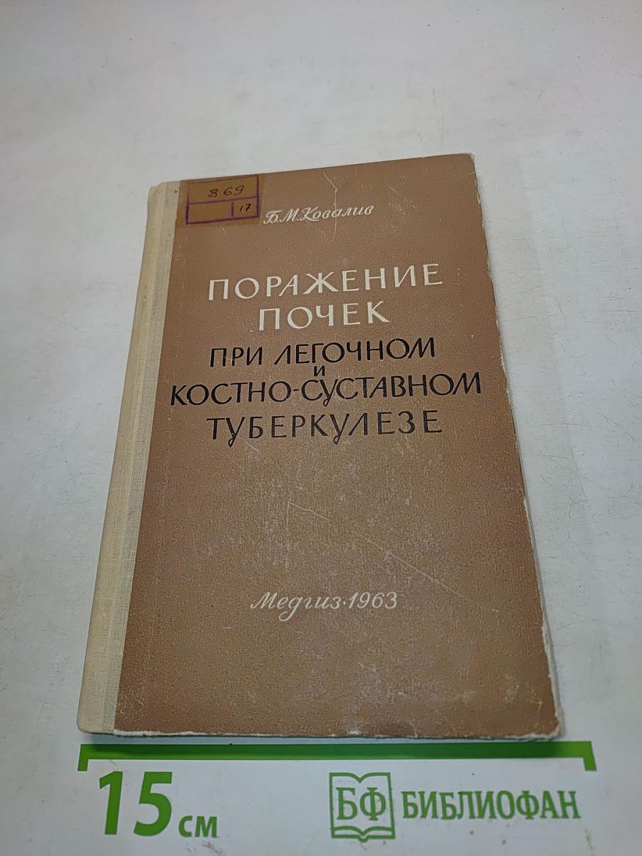 Поражение почек при легочном и костно-суставном туберкулезе