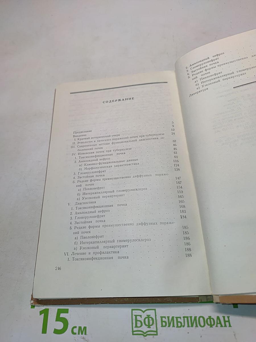 Поражение почек при легочном и костно-суставном туберкулезе