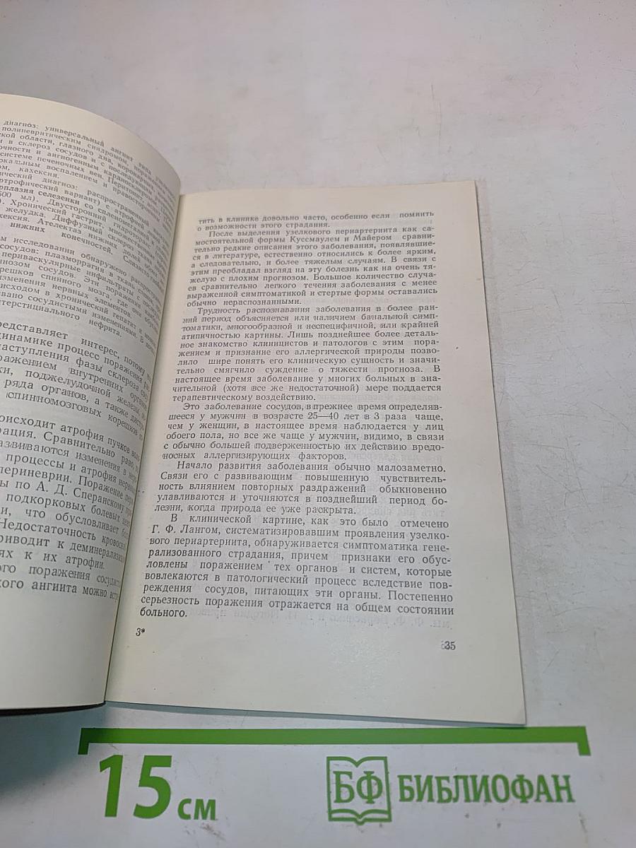 Аллергические заболевания периферических сосудов