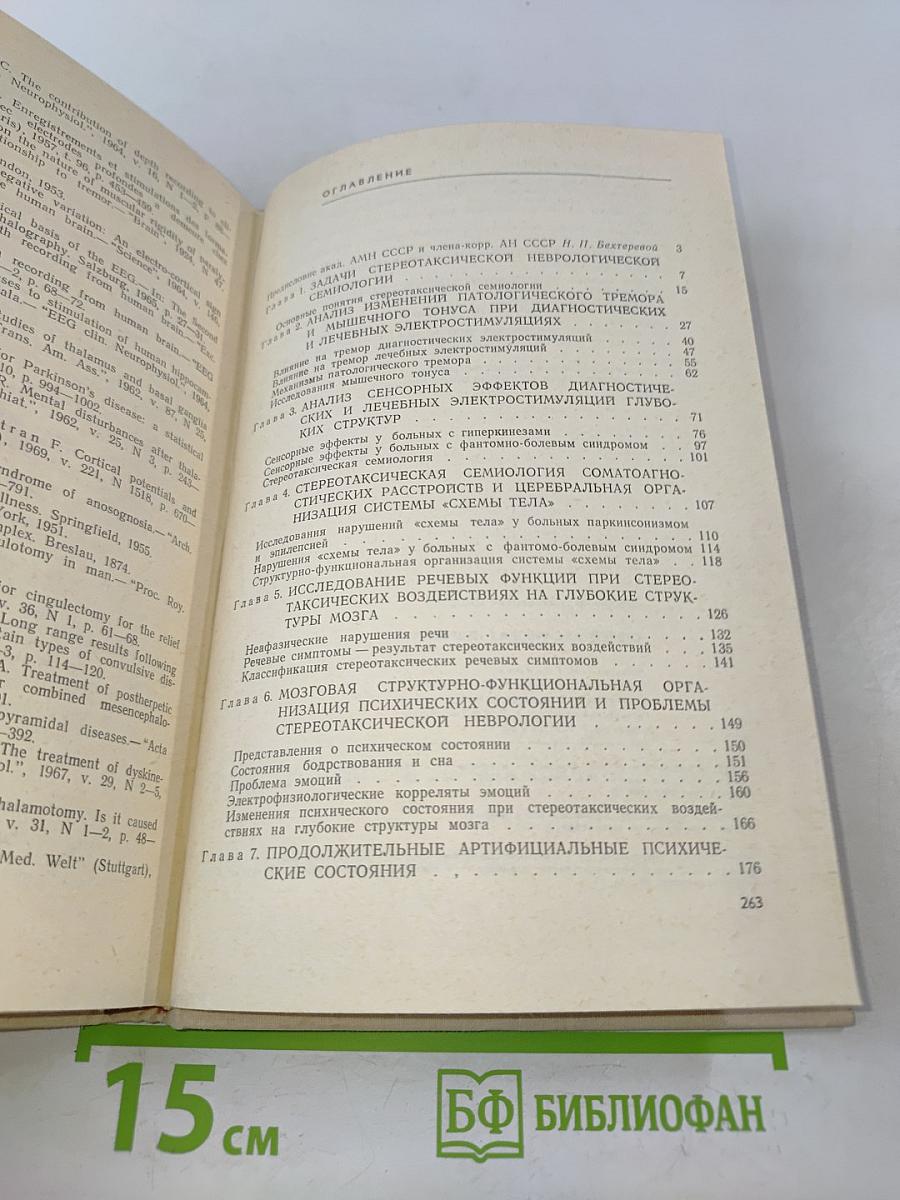 Стереотаксическая неврология