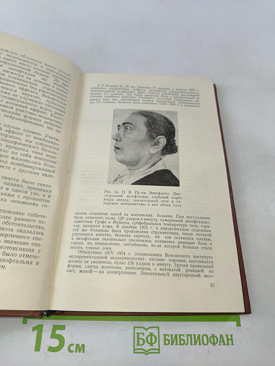 Неврологический анализ тиреотоксикоза