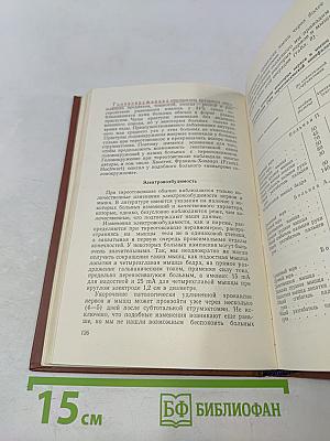 Неврологический анализ тиреотоксикоза