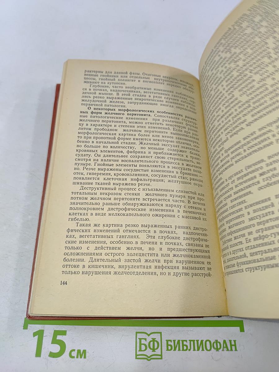 Желчный перитонит