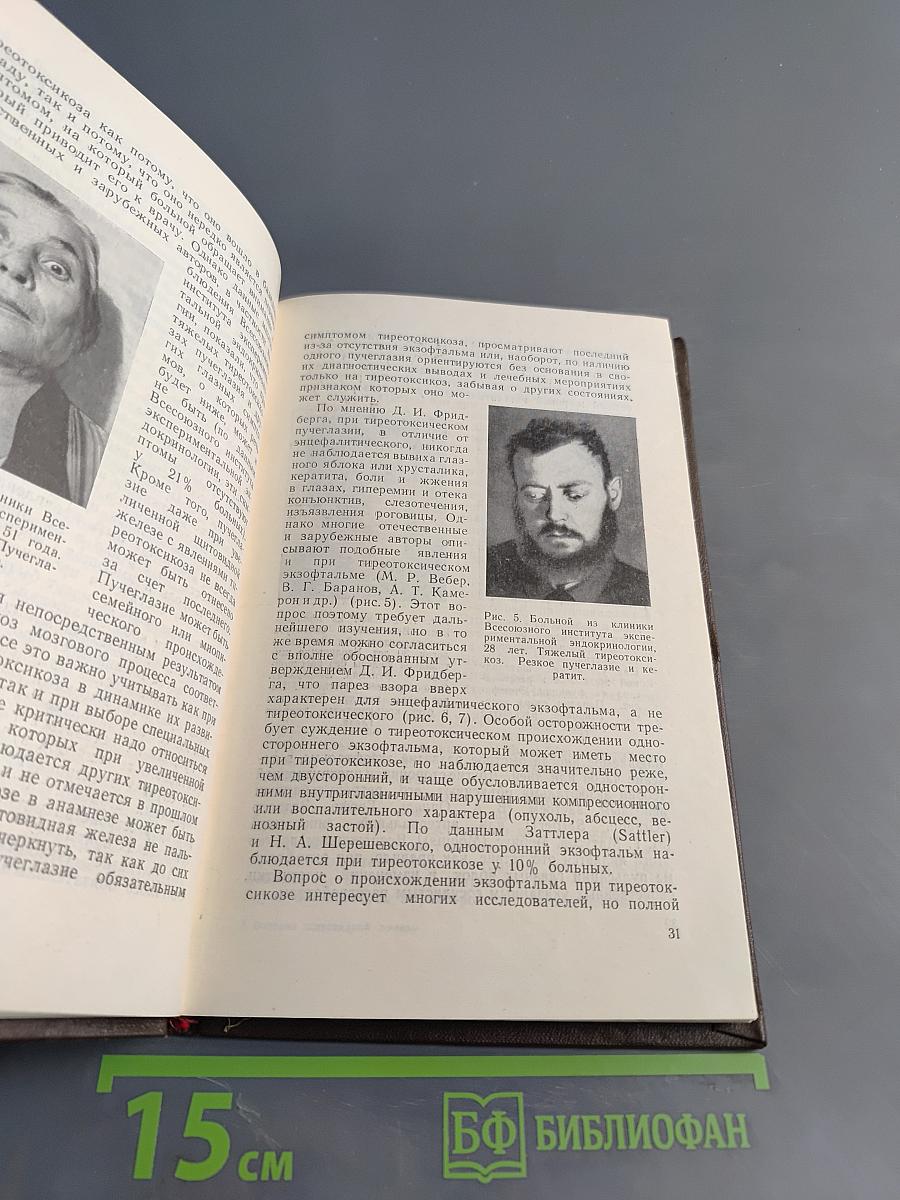 Болезни щитовидной железы