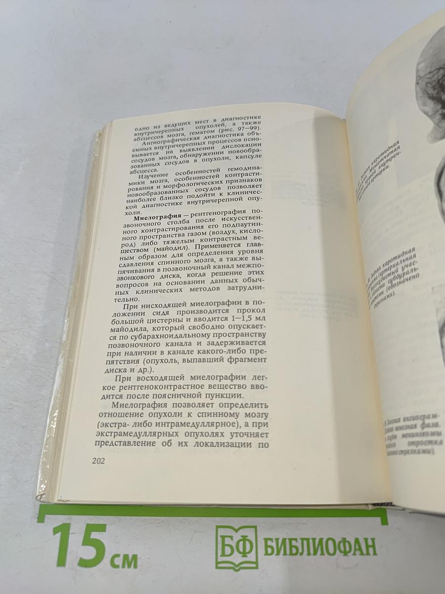 Атлас топической диагностики заболеваний нервной системы