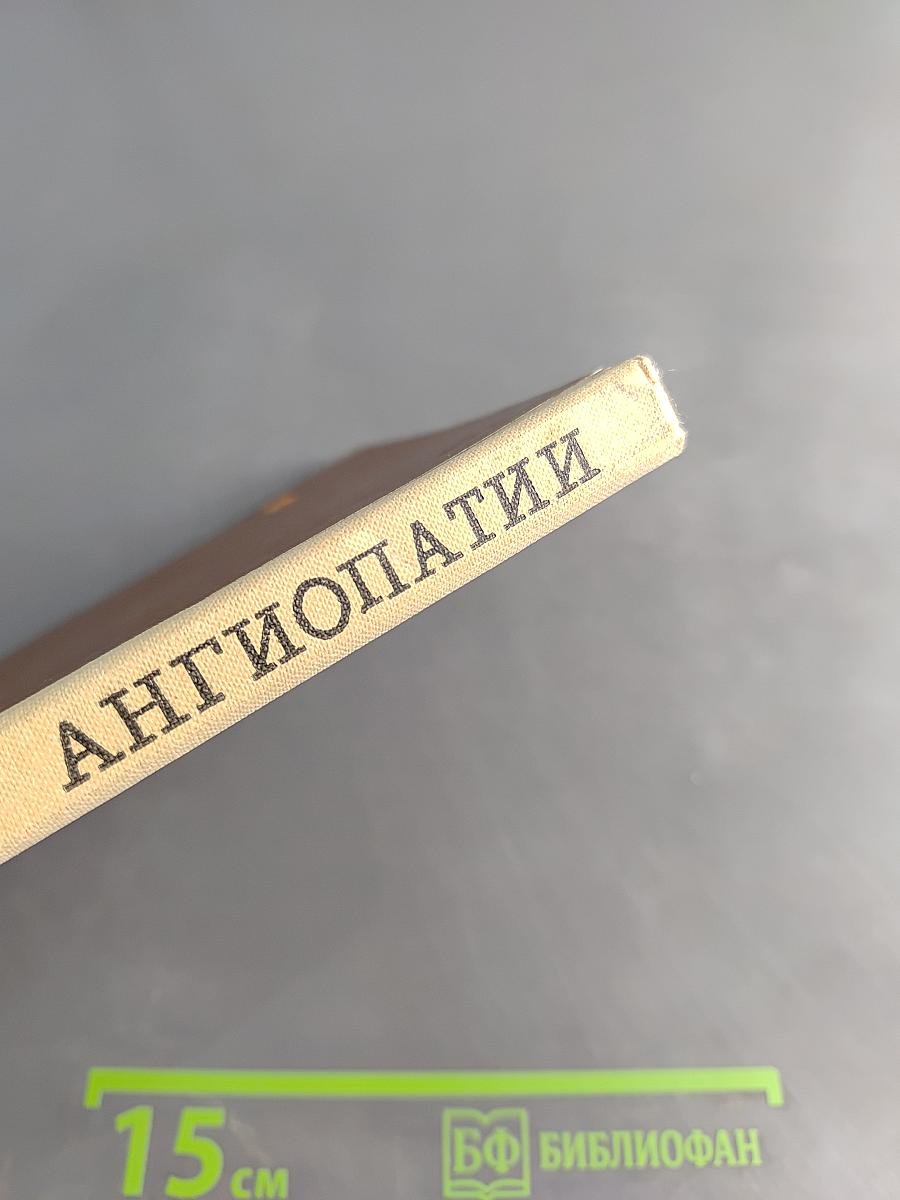 Диабетические ангиопатии