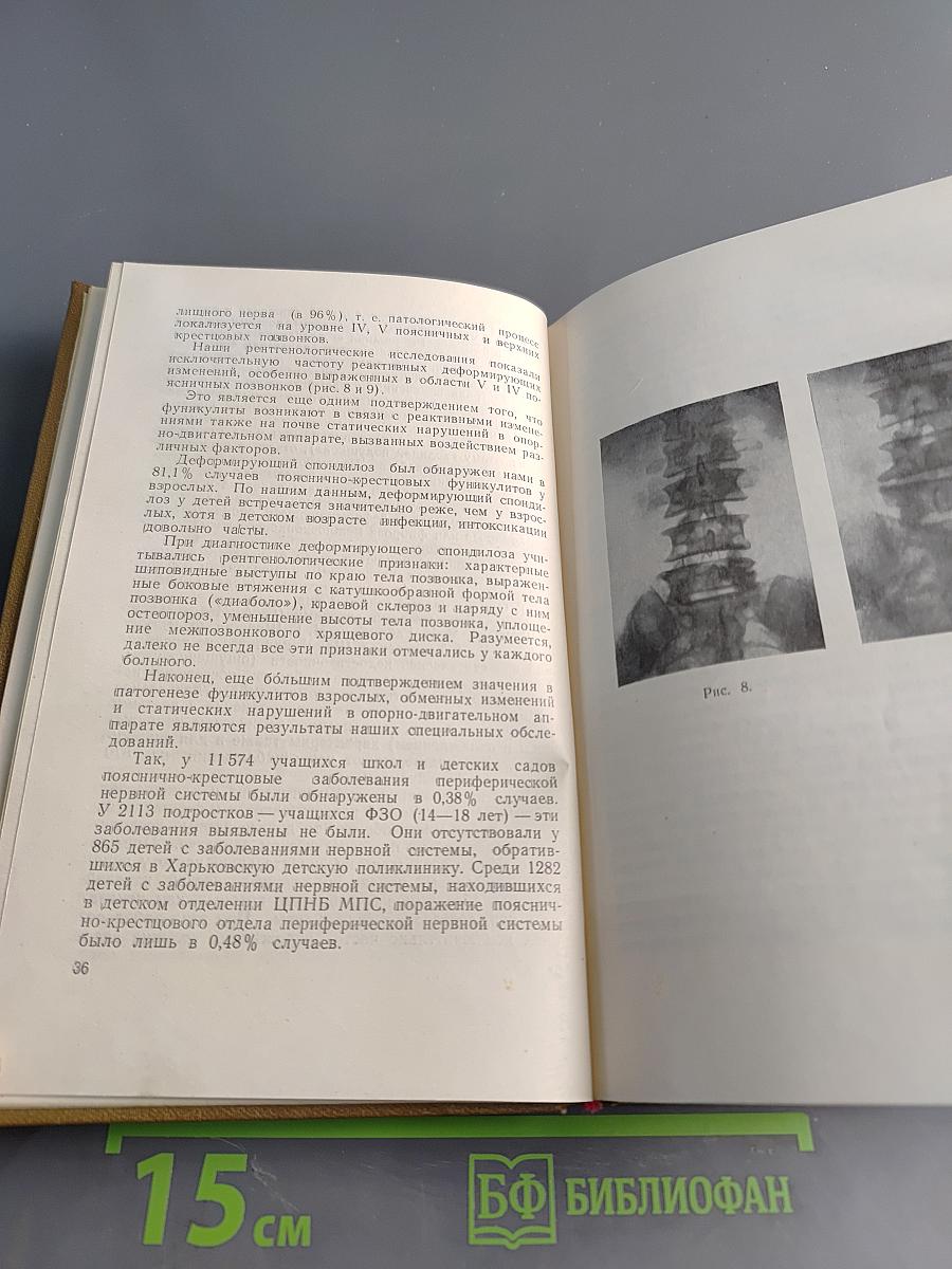 Заболевания пояснично-крестцового отдела периферической нервной системы