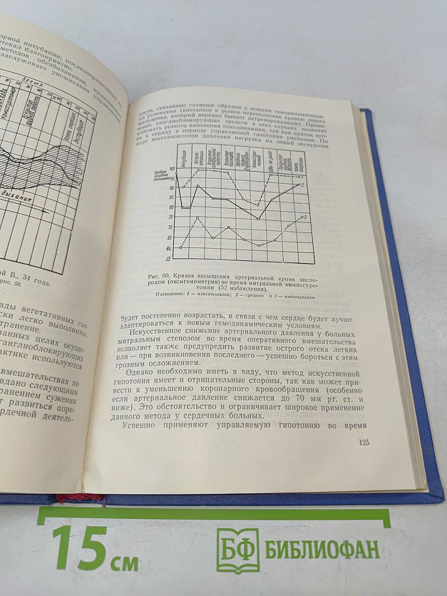 Хирургическое лечение митрального стеноза