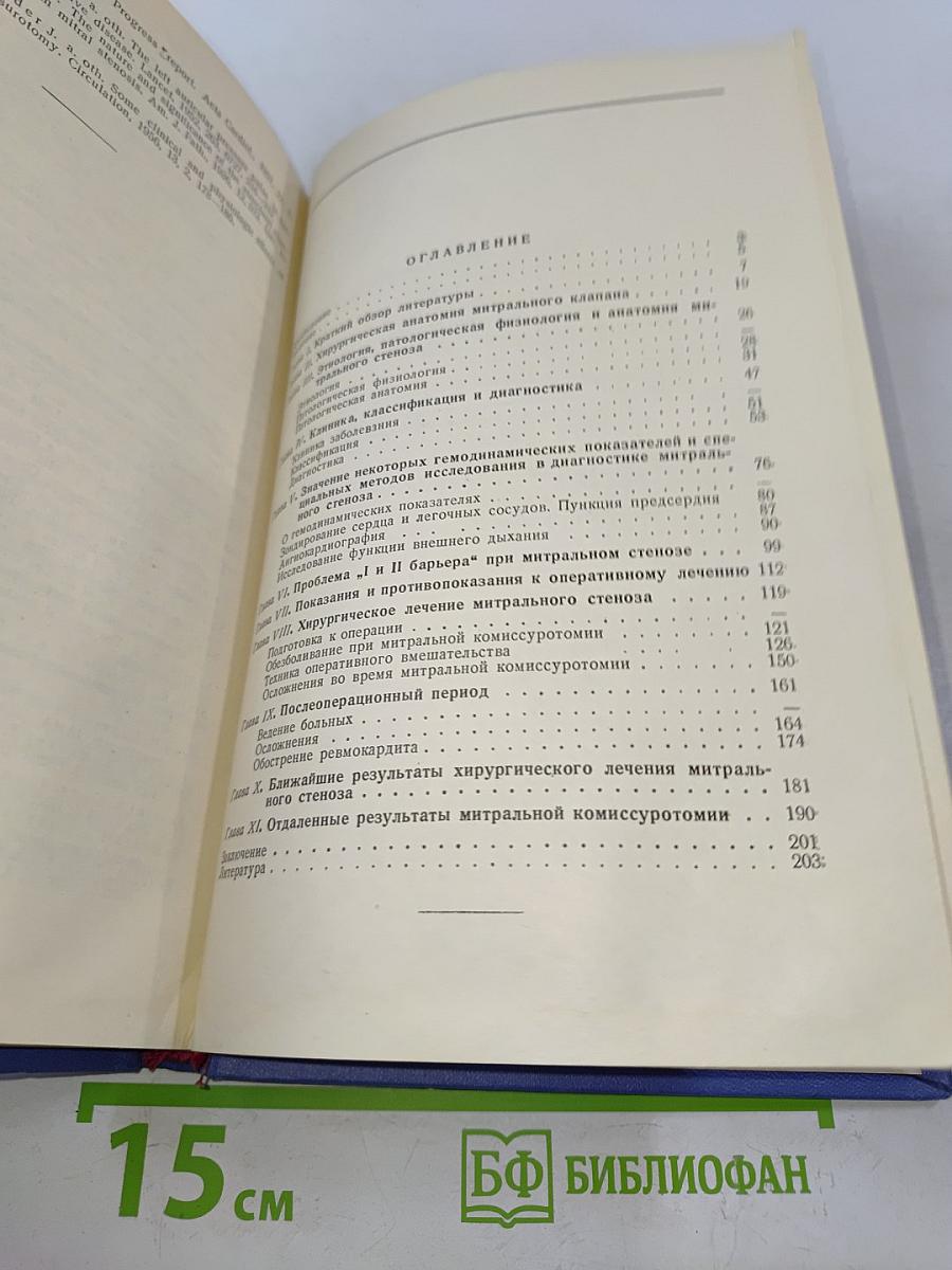 Хирургическое лечение митрального стеноза