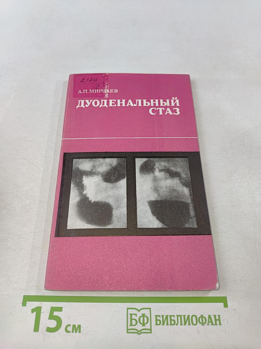 Дуоденальный стаз