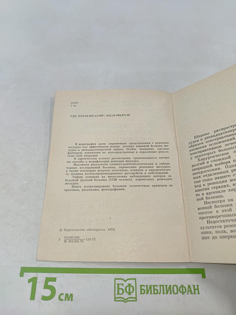 Улучшение результатов резекции желудка при язвенной болезни