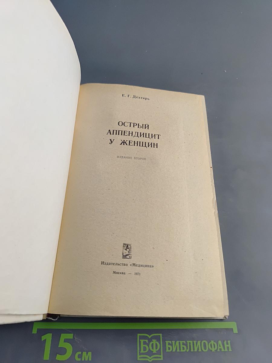 Острый аппендицит у женщин