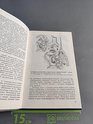 Урологические осложнения при лечении онкологических заболеваний органов таза