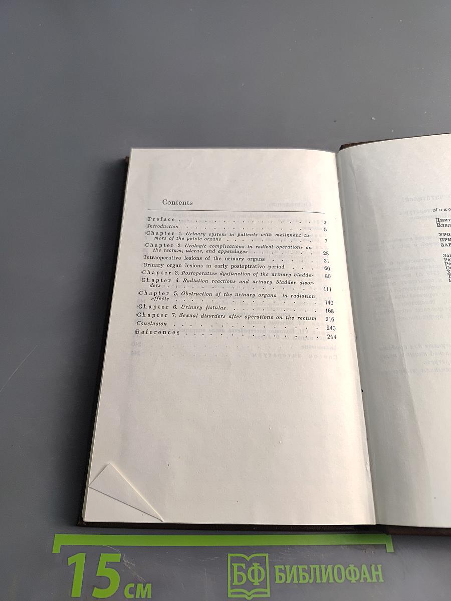 Урологические осложнения при лечении онкологических заболеваний органов таза
