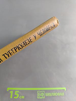 Гистопатология нервной системы при туберкулезе у человека