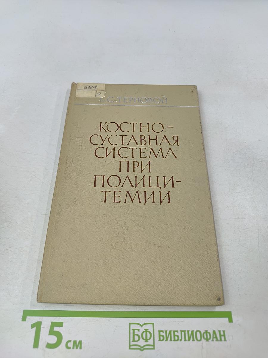 Костно-суставная система при полицитемии