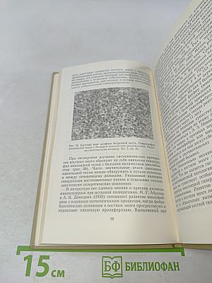 Костно-суставная система при полицитемии