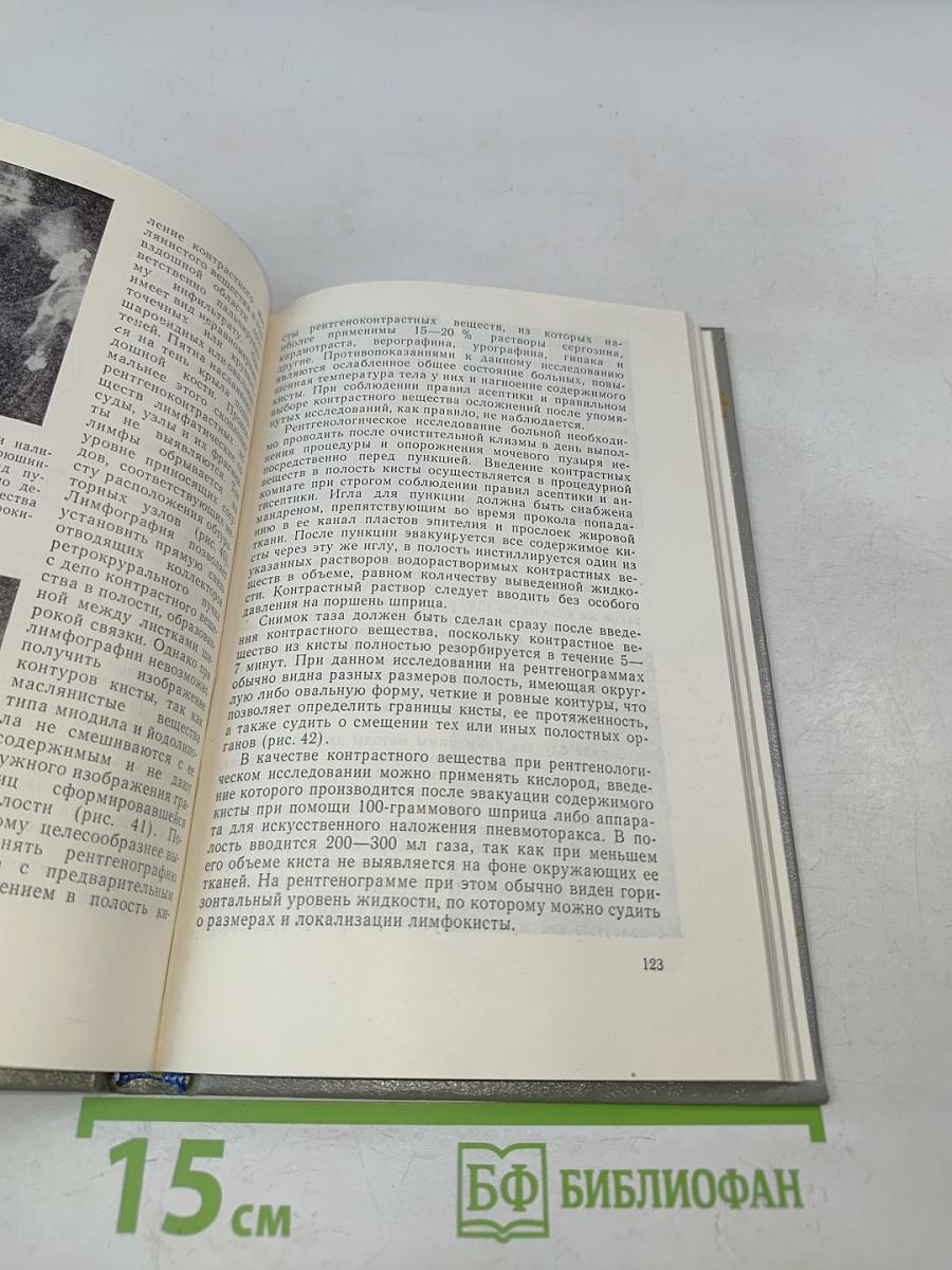 Справочник по онкогинекологии