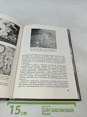 Гидронефротическая трансформация