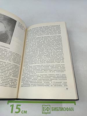 Электростимуляция мочевого пузыря