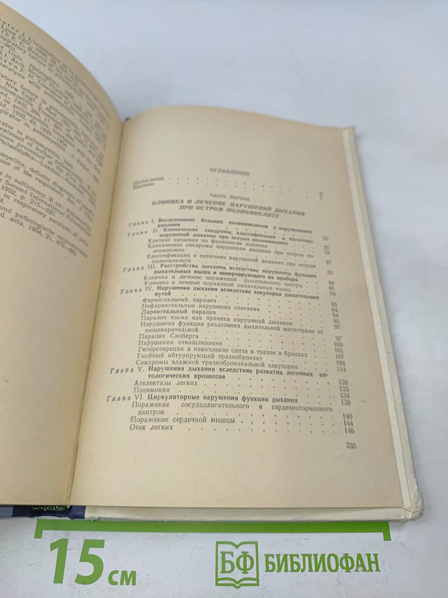 Нарушения дыхания при остром полиомиелите и других заболеваниях