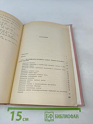 Рассеянный склероз и энцефаломиелит