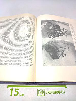 Лихорадка