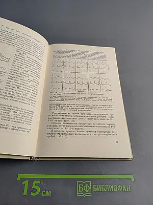 Реографическая диагностика сосудистых заболеваний головного мозга