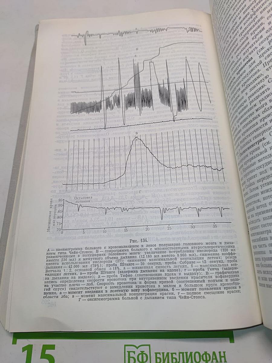 Церебральные кризы и инсульт