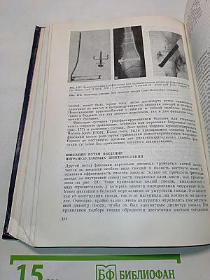 Имплантаты в хирургии