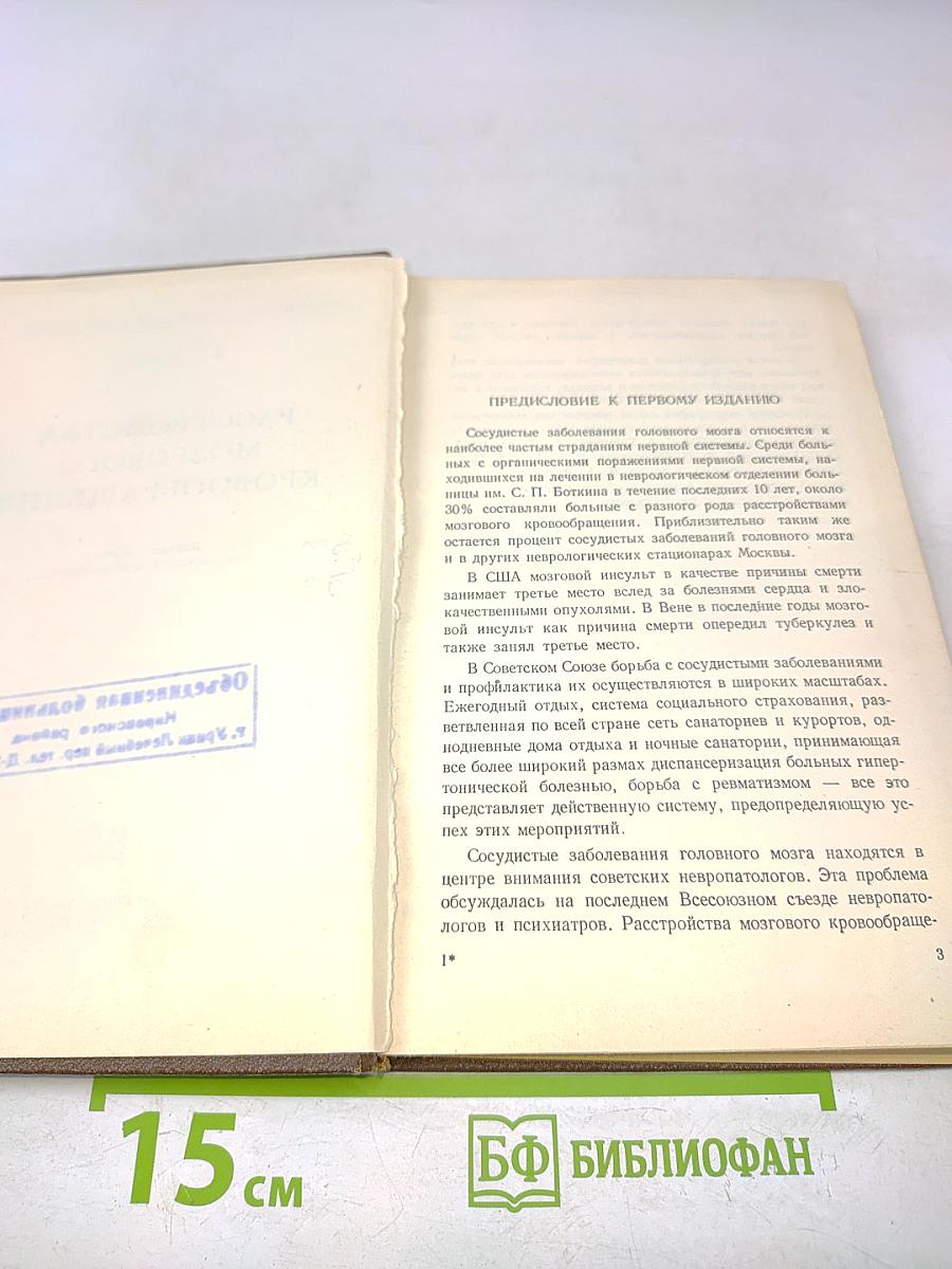 Расстройства мозгового кровообращения