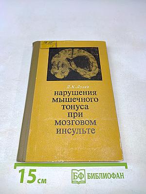 Нарушения мышечного тонуса при мозговом инсульте