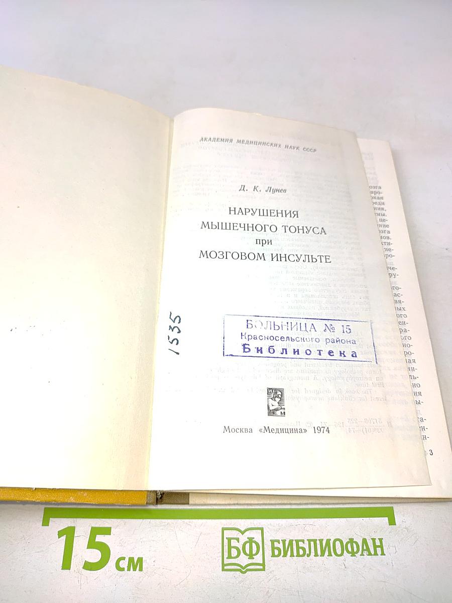 Нарушения мышечного тонуса при мозговом инсульте