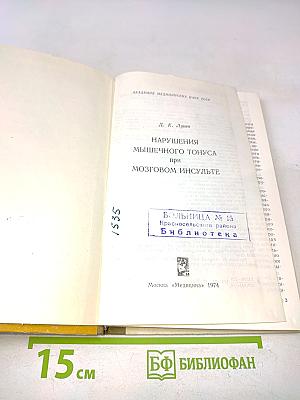 Нарушения мышечного тонуса при мозговом инсульте