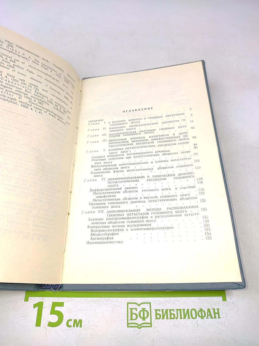 Метастатические абсцессы головного мозга