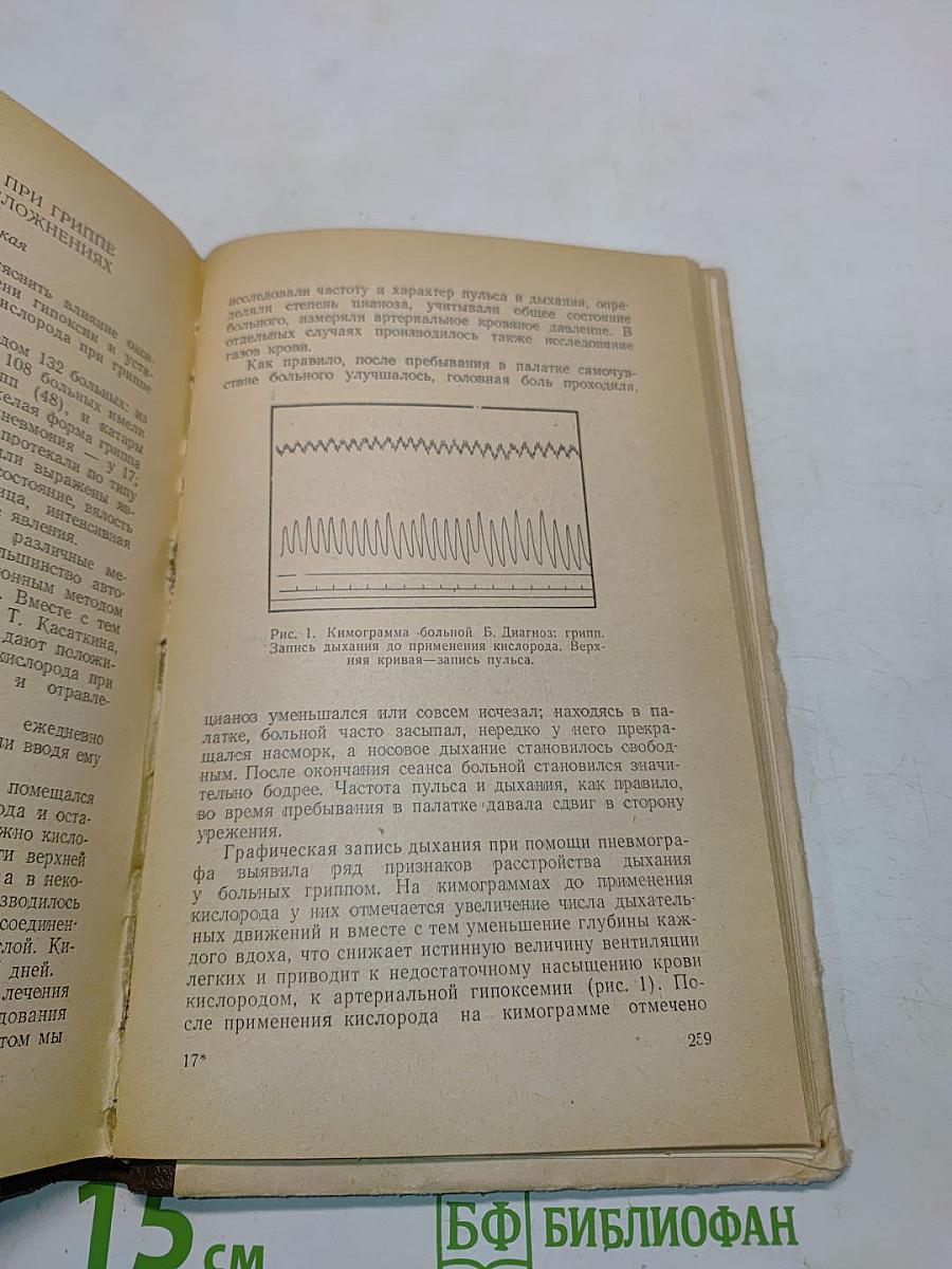 Грипп (Эпидемиология, этиология, патогенез, клиника и лечение)
