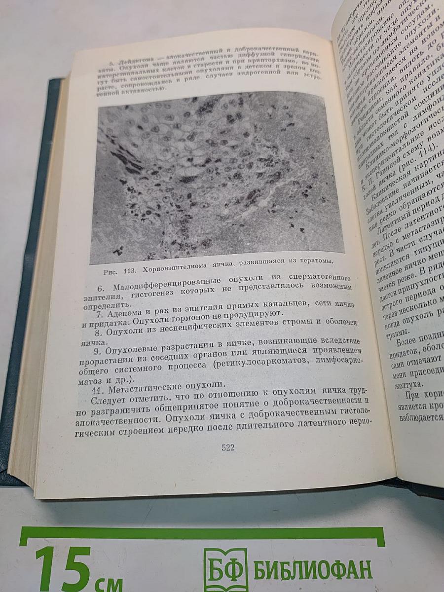 Злокачественные опухоли и предществующие заболевания