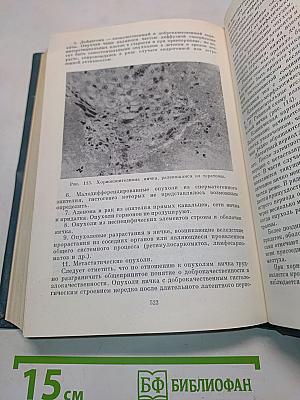 Злокачественные опухоли и предществующие заболевания