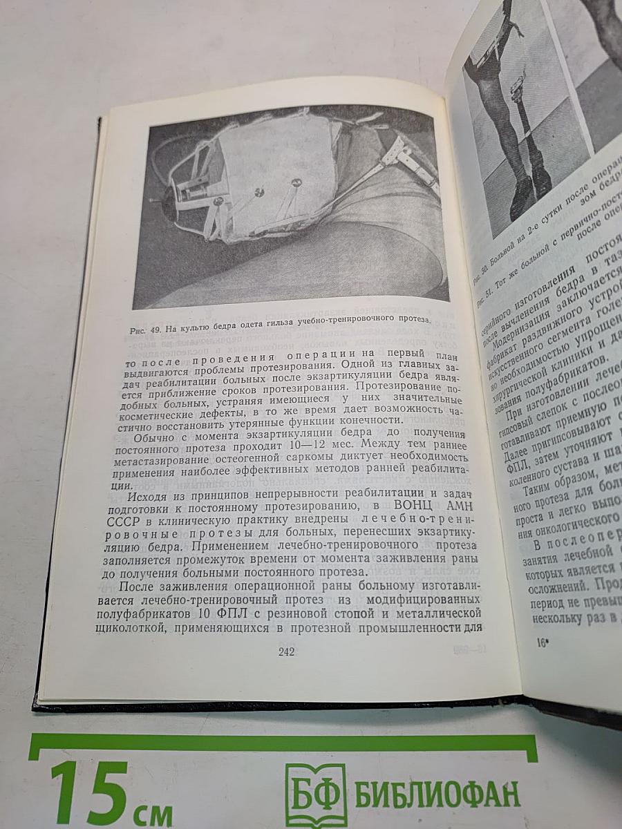 Реабилитация онкологических больных