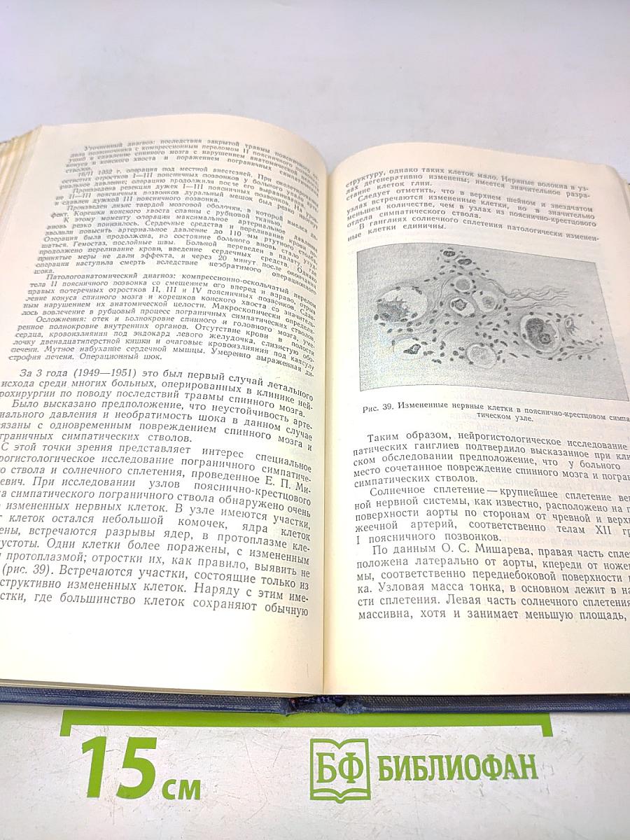 Повреждения позвоночника и спинного мозга и их хирургическое лечение
