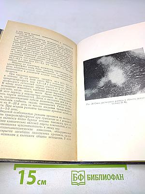 Токсические полиневриты и энцефаломиелополиневриты