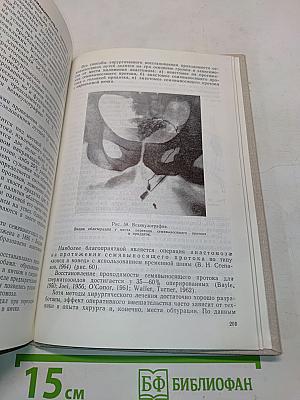 Стерильность у мужчин