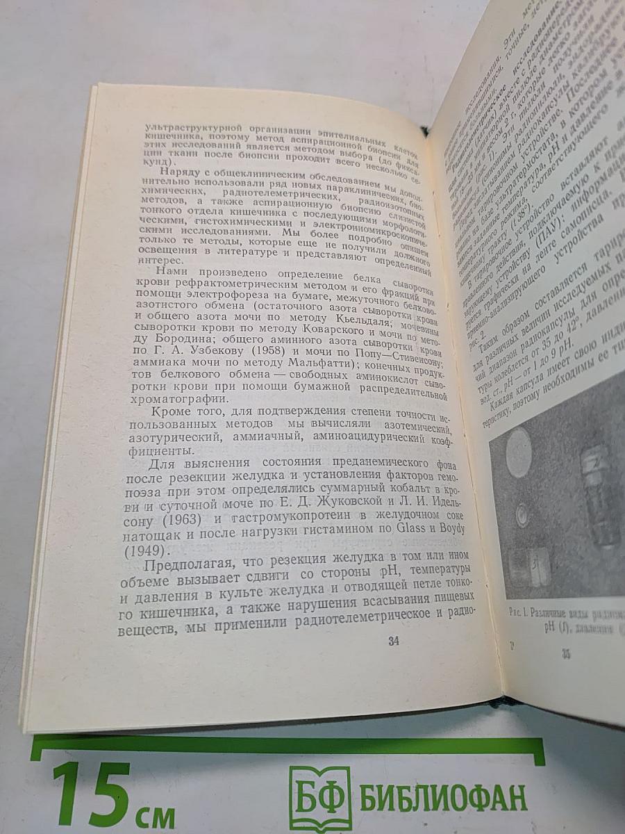 Постгастрорезекционный синдром